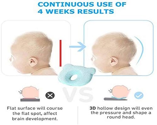 baby head-shaping pillows helps in keeping the skull shape right and 